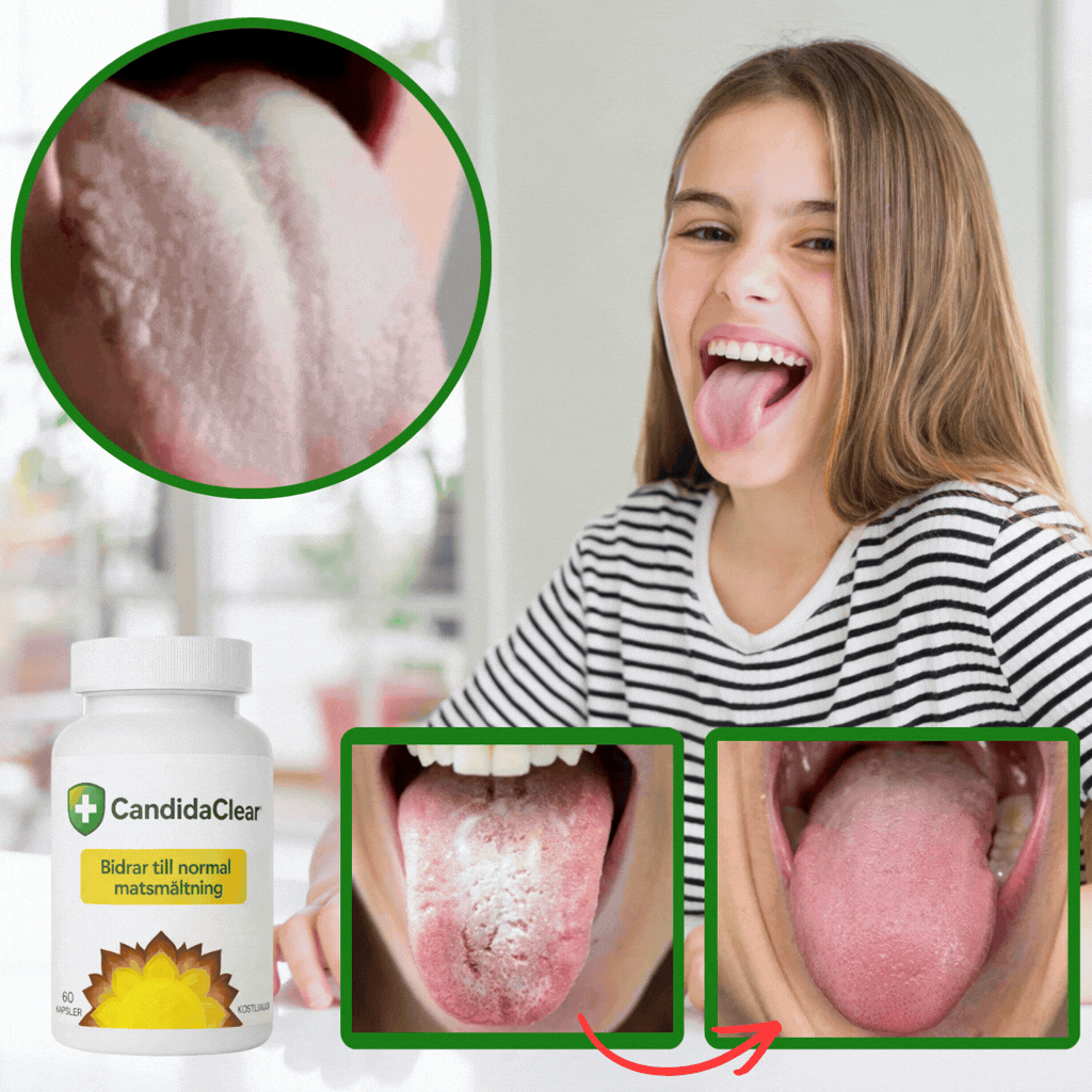 CandidaClean™ Mun- och tarmbalans kapslar | Tar bort vita beläggningar på tungan till 95 % på endast 2 dagar!