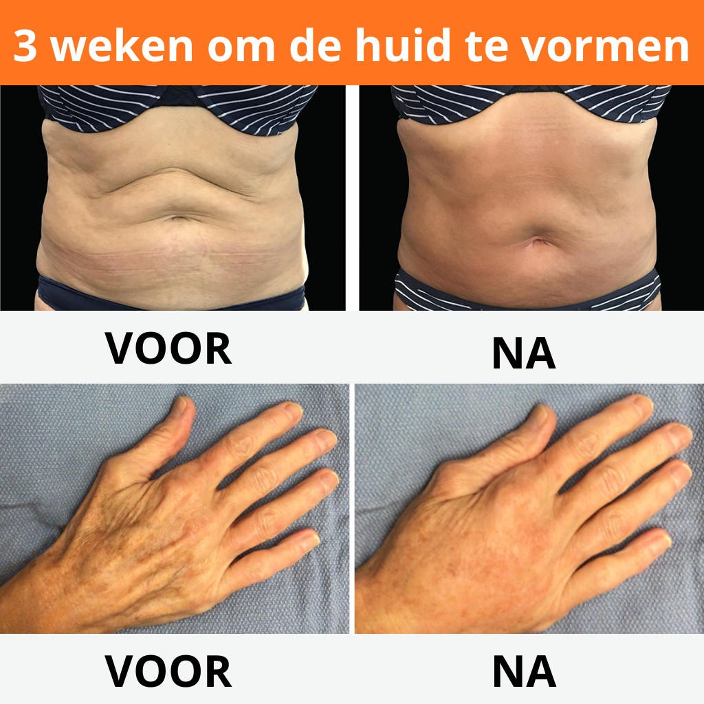 Dermaluxe™ - Bigift Hudreparationskräm - Återställ din hud på 7 dagar 