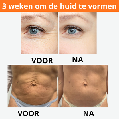 Dermaluxe™ - Bigift Hudreparationskräm - Återställ din hud på 7 dagar 
