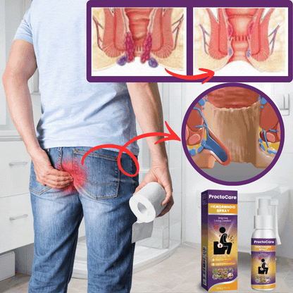 ProctoCare™ hemorrojdspray | Minskar hemorrojd­besvär med upp till 89 % inom 24 timmar