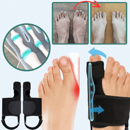 HalluxFix™ Stödskena